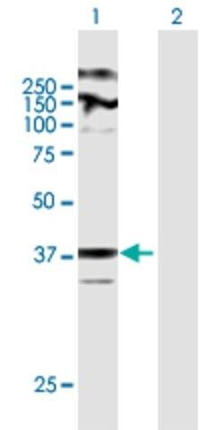 Anti-ZDHHC23 antibody produced in mouse