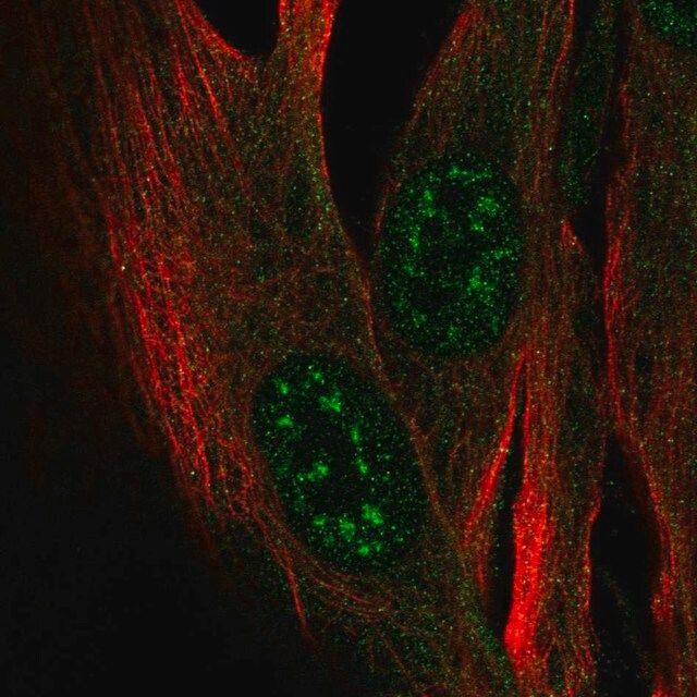 Anti-ZCWPW2 antibody produced in rabbit