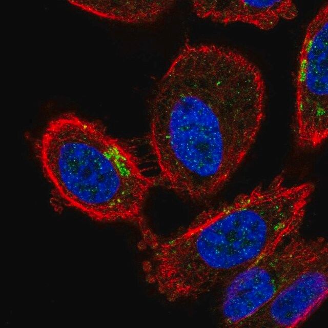 Anti-ZDHHC7 antibody produced in rabbit