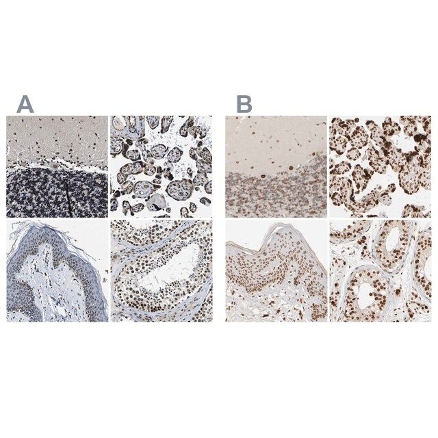 Anti-ZC3HC1 antibody produced in rabbit