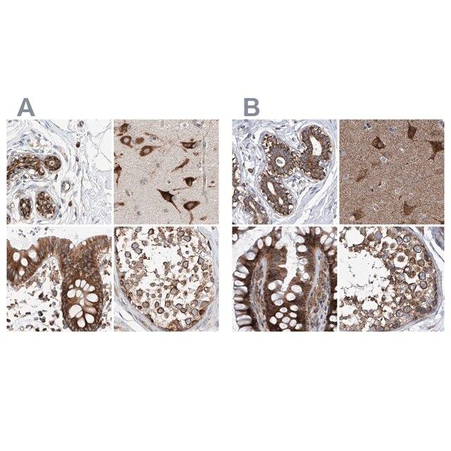 Anti-ZC3H15 antibody produced in rabbit