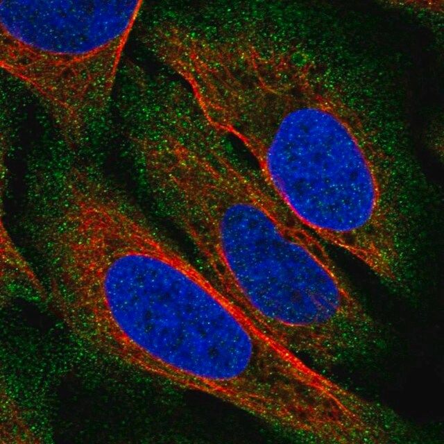 Anti-ZDHHC22 antibody produced in rabbit