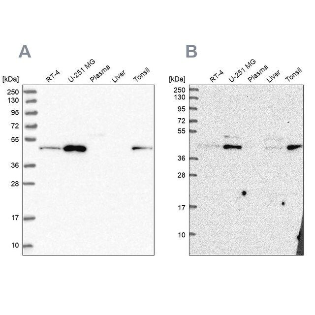 Anti-ZDHHC16 antibody produced in rabbit