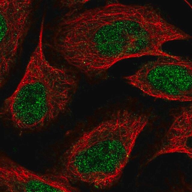 Anti-ZDBF2 antibody produced in rabbit