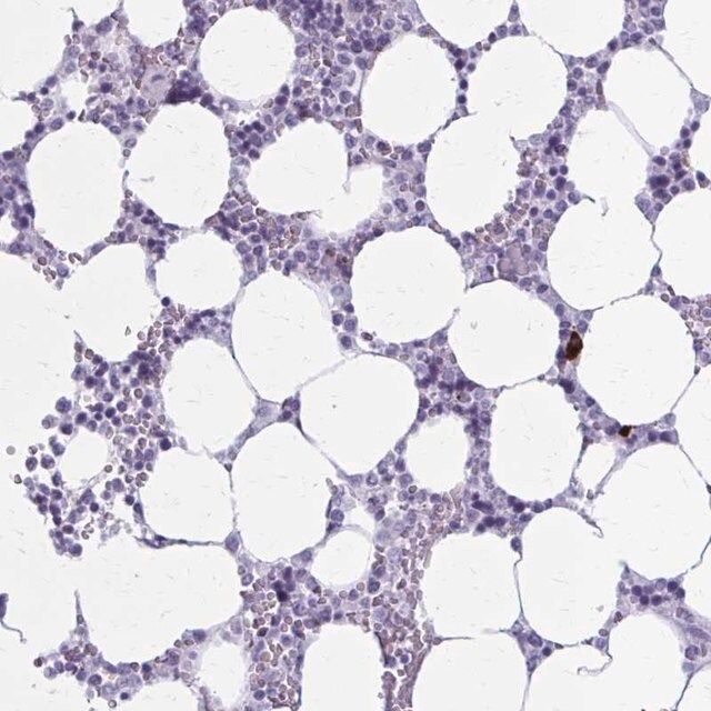 Anti-ZDHHC7 antibody produced in rabbit