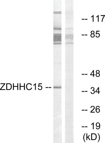 Anti-ZDHHC15 antibody produced in rabbit