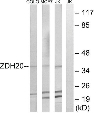 Anti-ZDHHC20 antibody produced in rabbit