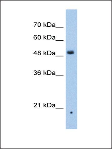 Anti-ZDHHC16 antibody produced in rabbit