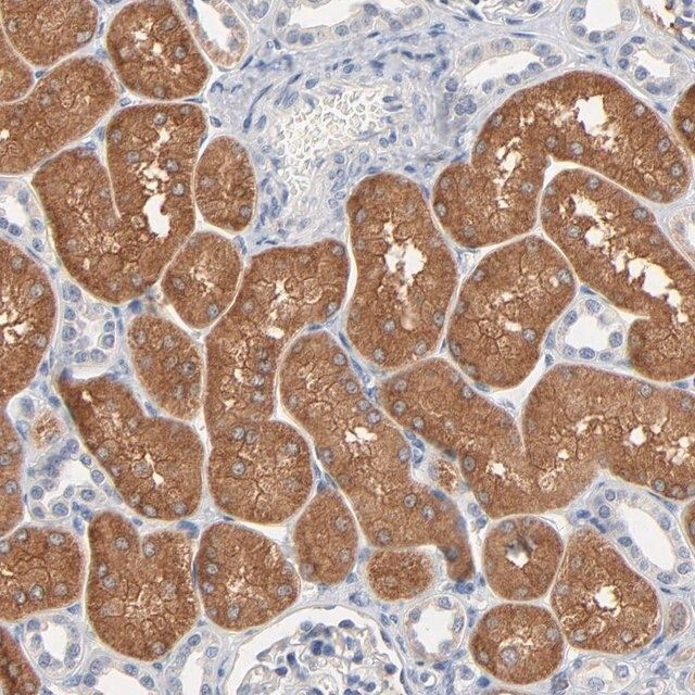 Anti-ZDHHC8 antibody produced in rabbit