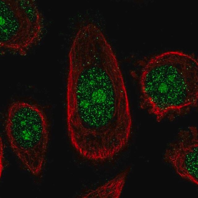 Anti-ZNF16 antibody produced in rabbit