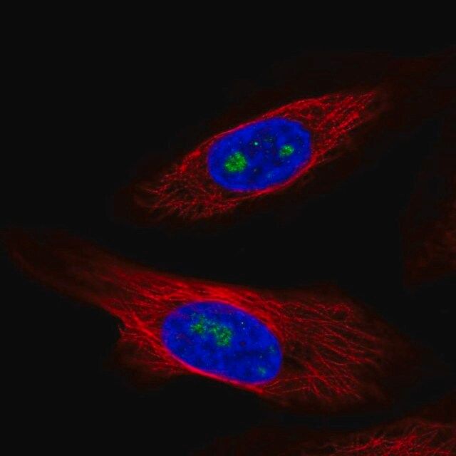 Anti-ZNF57 antibody produced in rabbit