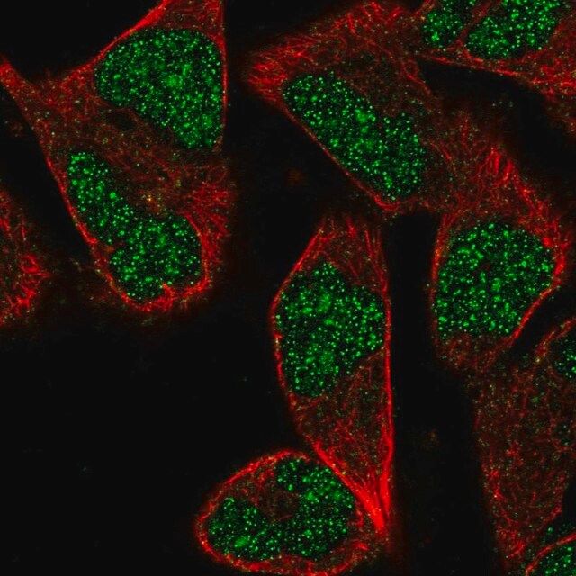 Anti-ZNF627 antibody produced in rabbit