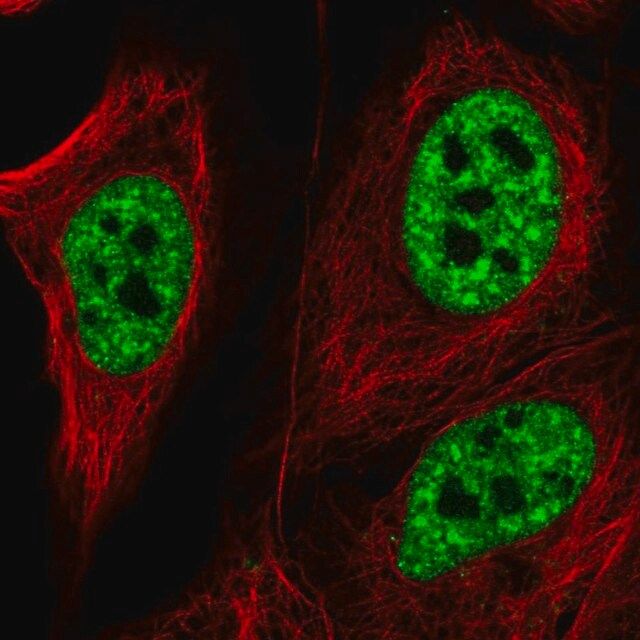 Anti-ZNF621 antibody produced in rabbit