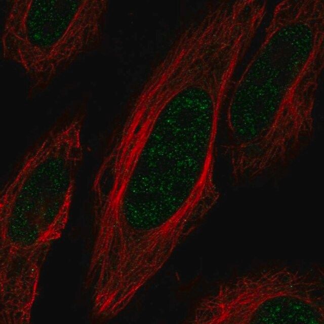 Anti-ZNF621 antibody produced in rabbit