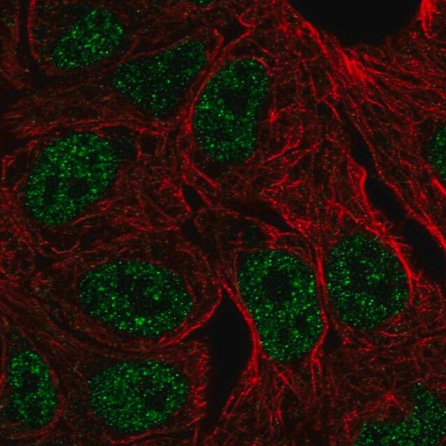 Anti-ZNF283 antibody produced in rabbit