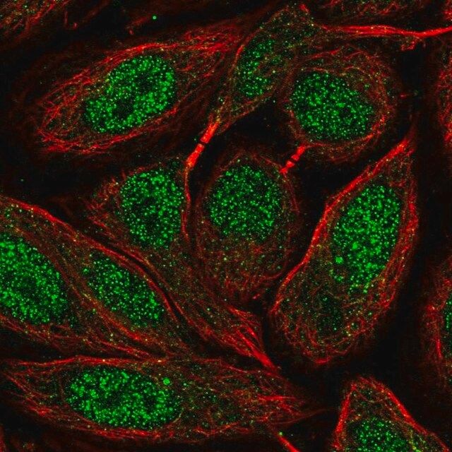 Anti-ZNF630 antibody produced in rabbit