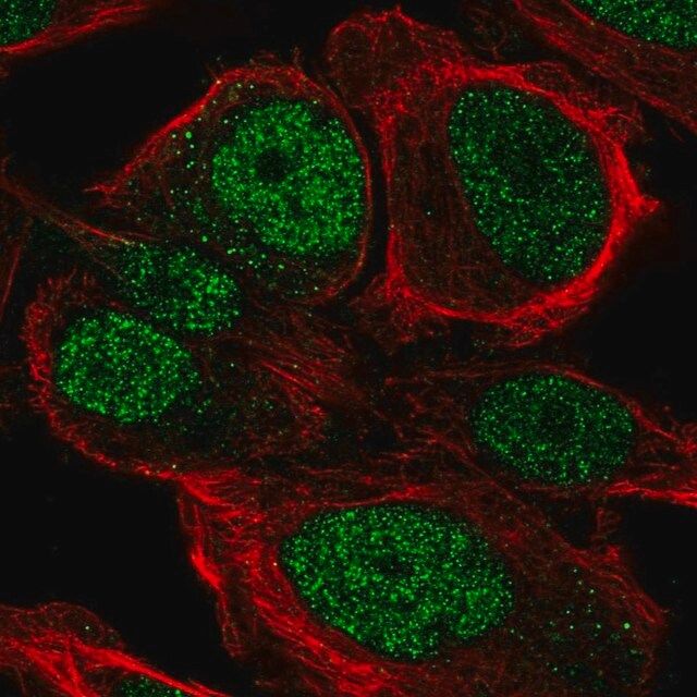 Anti-ZNF561 antibody produced in rabbit