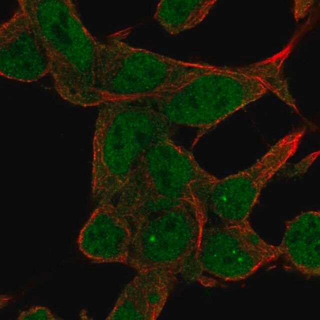 Anti-ZNF829 antibody produced in rabbit