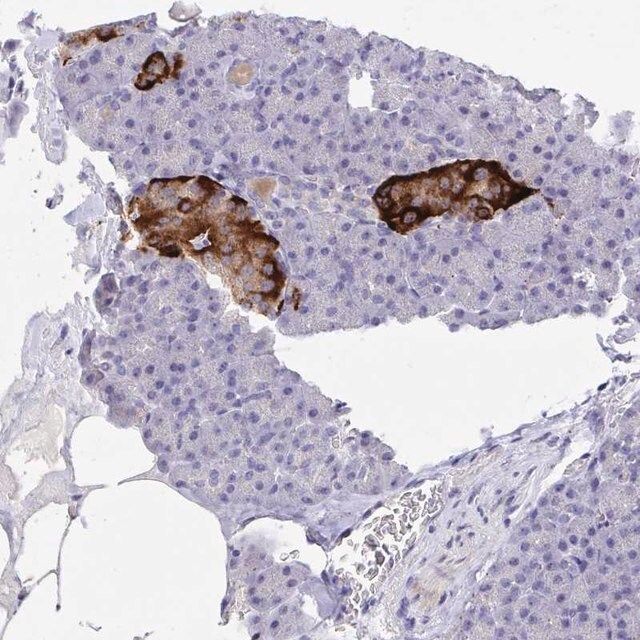 Anti-ZNF561 antibody produced in rabbit