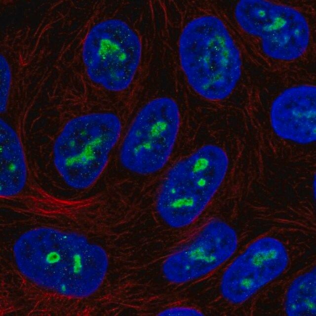 Anti-ZNF713 antibody produced in rabbit