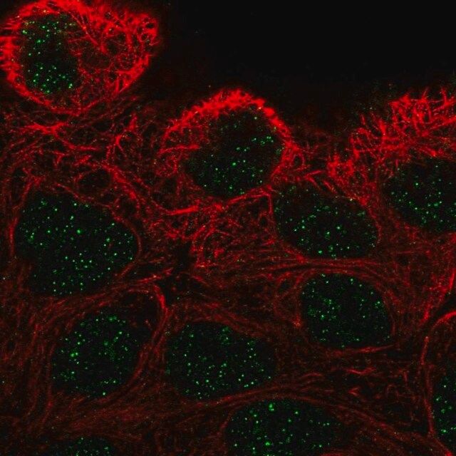 Anti-ZNF432 antibody produced in rabbit