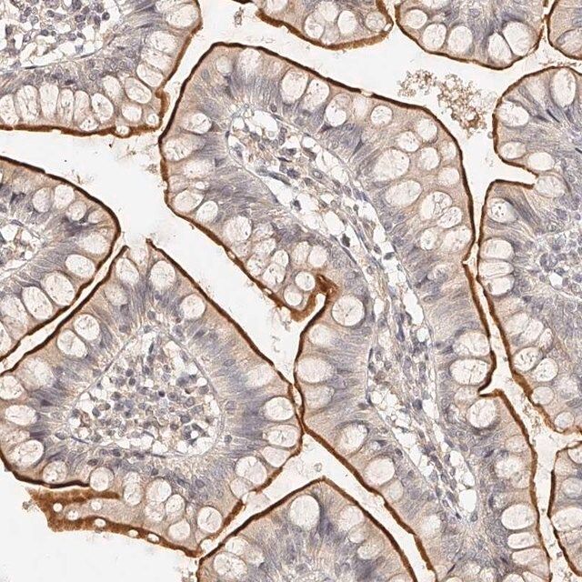 Anti-ZNF789 antibody produced in rabbit