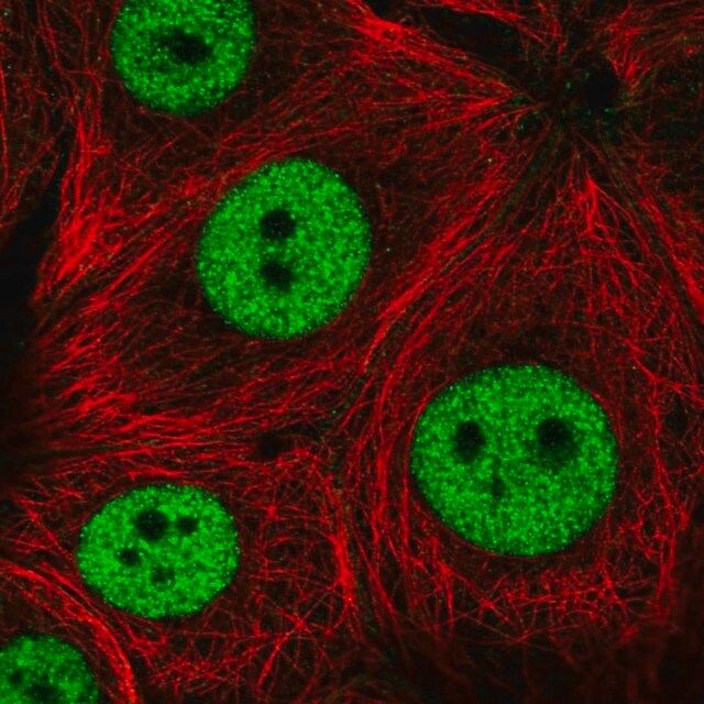 Anti-ZNF335 antibody produced in rabbit