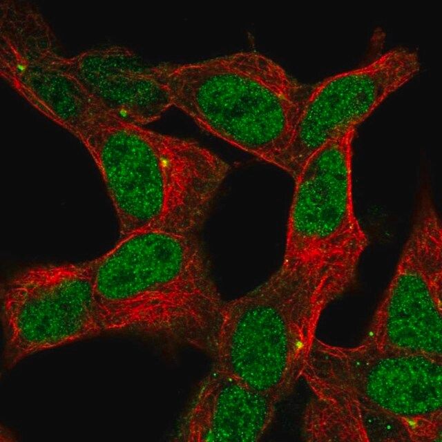 Anti-ZNF12 antibody produced in rabbit