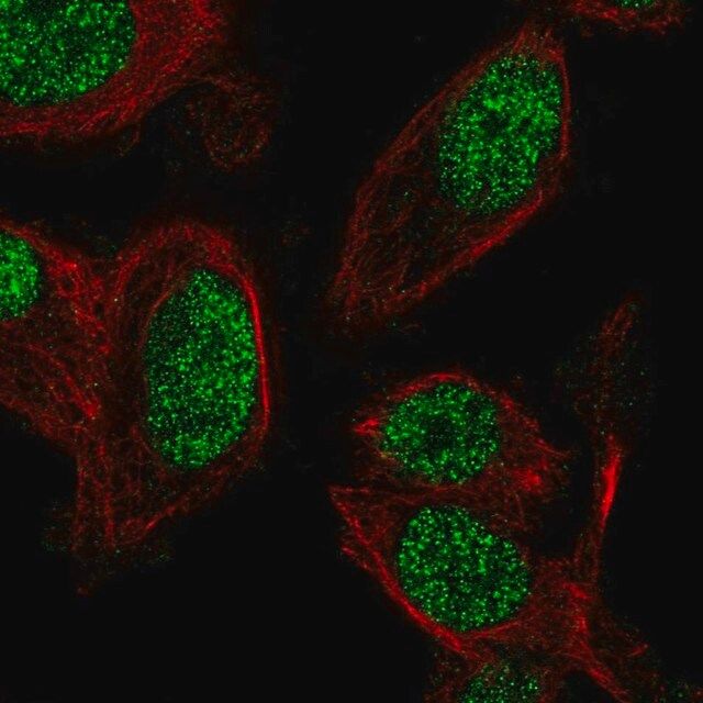 Anti-ZNF672 antibody produced in rabbit