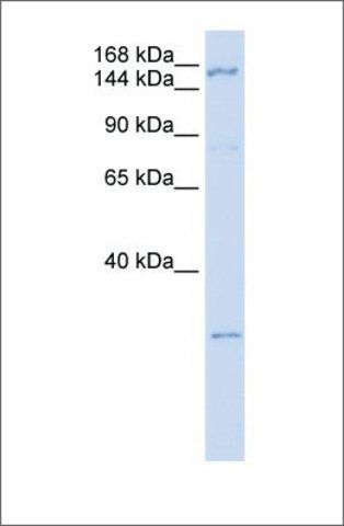 Anti-ZNF687 antibody produced in rabbit