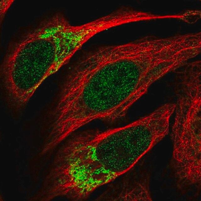 Anti-ZNF398 antibody produced in rabbit