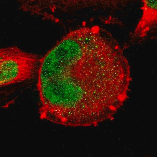 Anti-ZNF367 antibody produced in rabbit