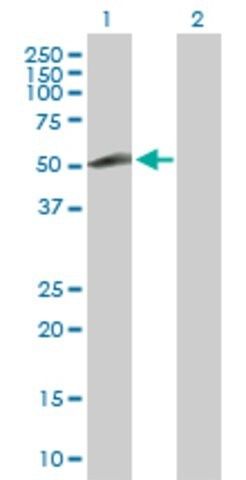 Anti-ZNF232 antibody produced in rabbit