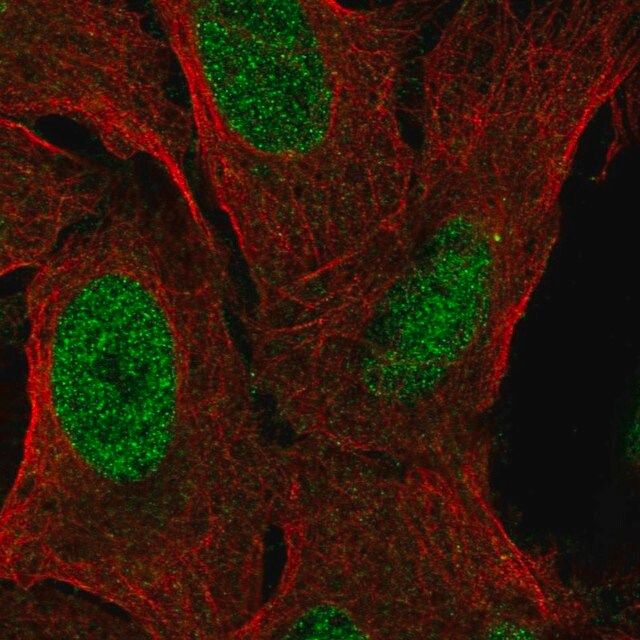 Anti-ZNF296 antibody produced in rabbit