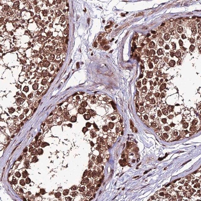 Anti-ZNF766 antibody produced in rabbit