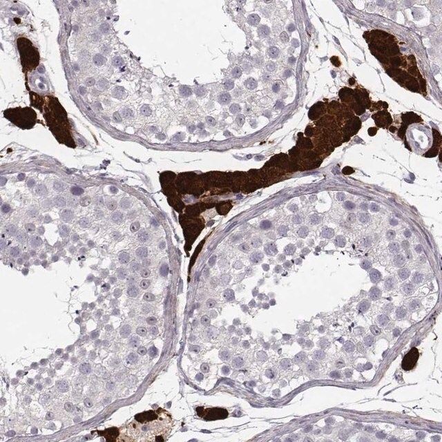 Anti-ZNF433 antibody produced in rabbit