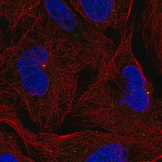 Anti-ZNF616 antibody produced in rabbit