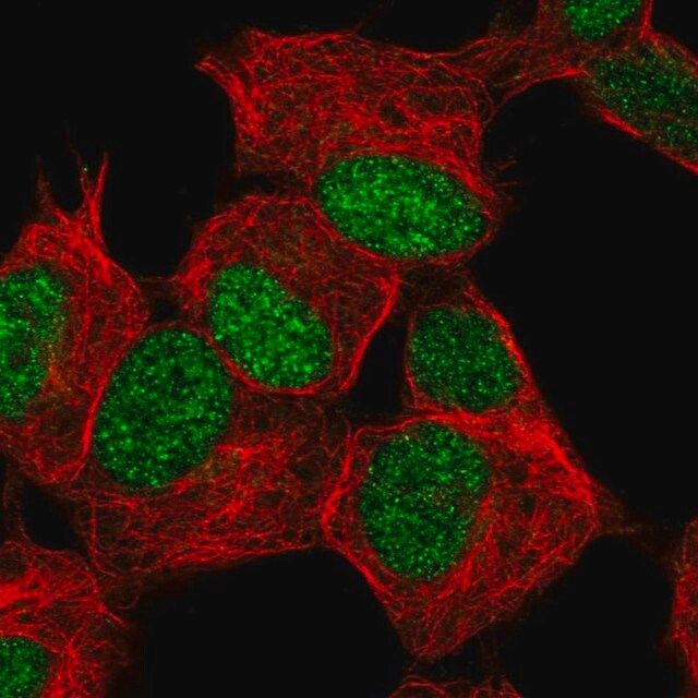 Anti-ZNF358 antibody produced in rabbit