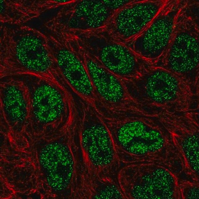 Anti-ZNF45 antibody produced in rabbit