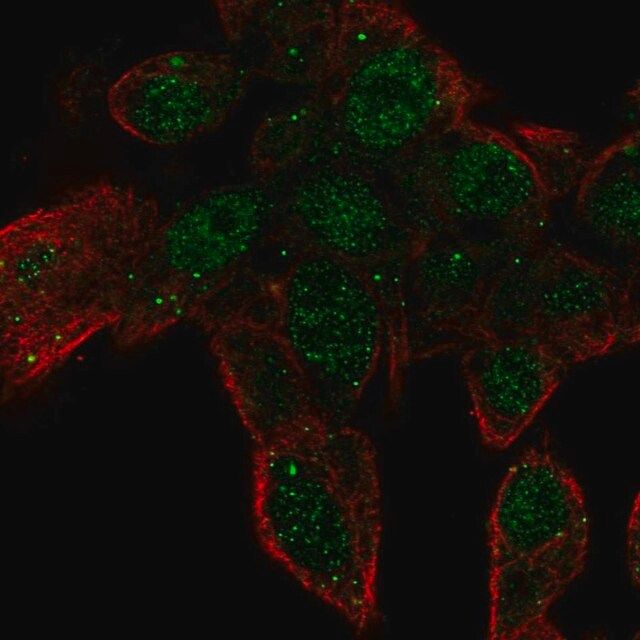 Anti-ZNF232 antibody produced in rabbit