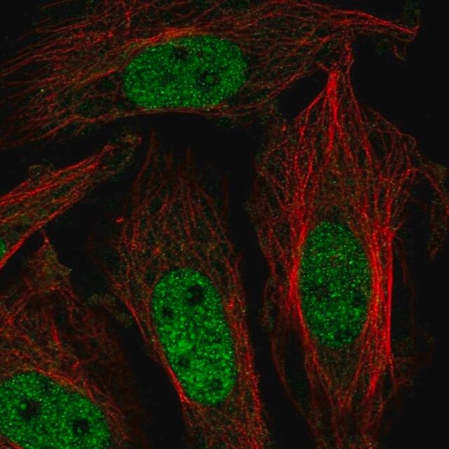 Anti-ZNF131 antibody produced in rabbit