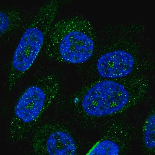 Anti-ZNF586 antibody produced in rabbit