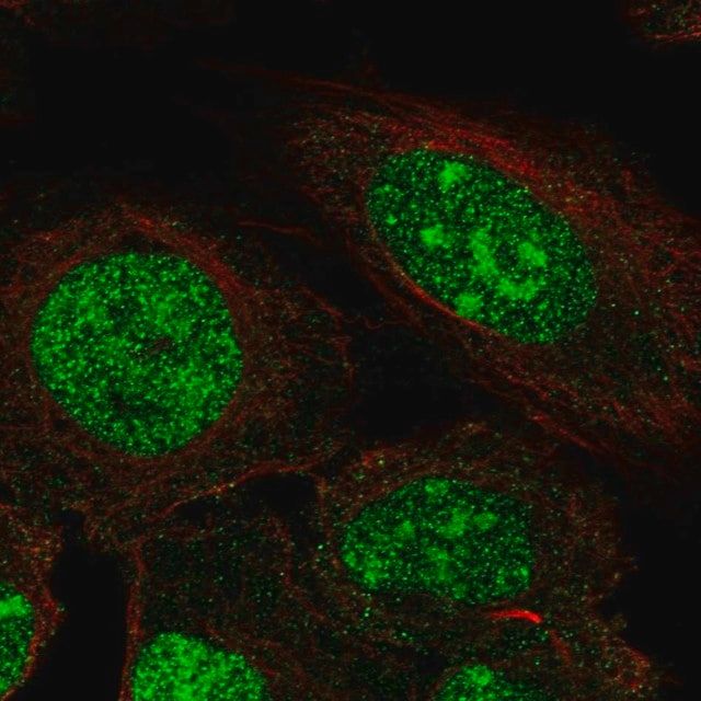 Anti-ZNF300 antibody produced in rabbit