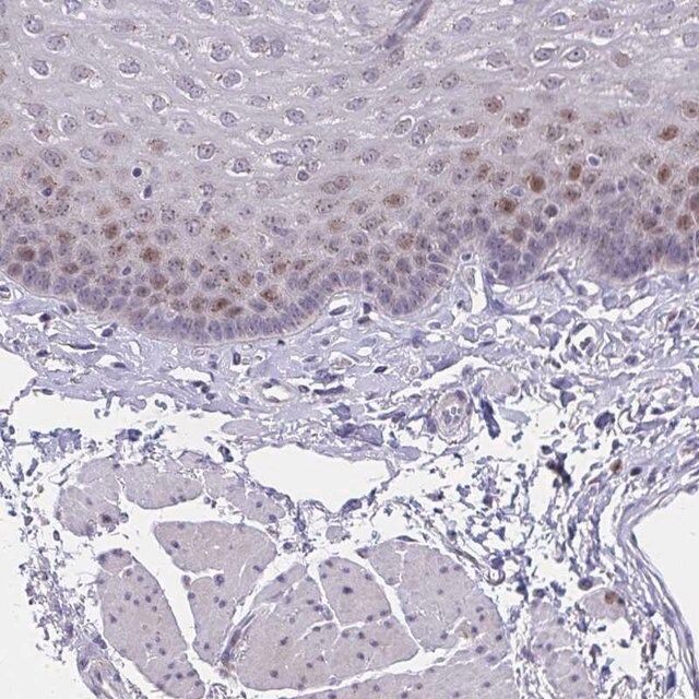 Anti-ZNF554 antibody produced in rabbit