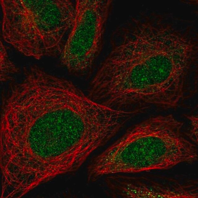 Anti-ZNF181 antibody produced in rabbit