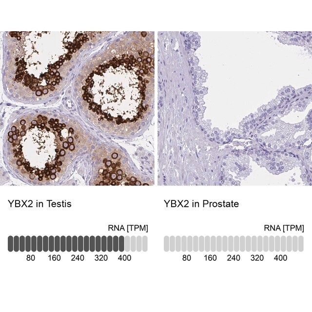 Anti-YBX2 antibody produced in rabbit