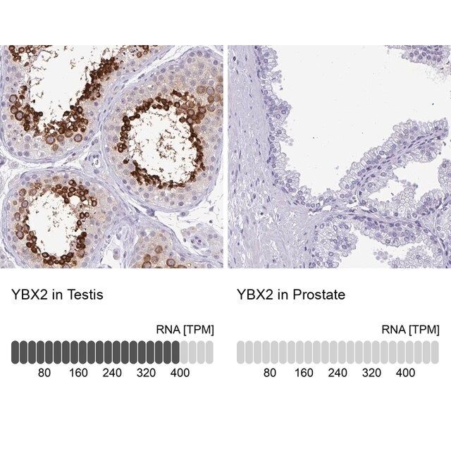 Anti-YBX2 antibody produced in rabbit