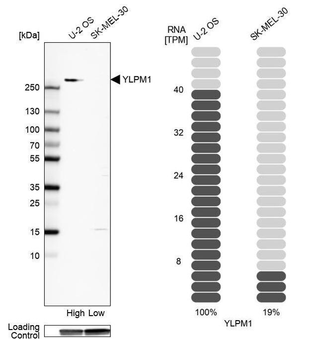 Anti-YLPM1 antibody produced in rabbit