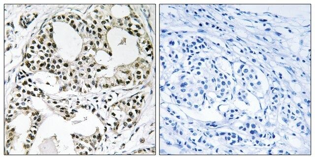 Anti-YEATS2 antibody produced in rabbit