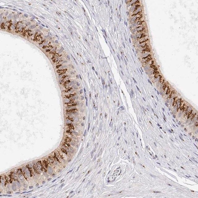 Anti-YIPF3 antibody produced in rabbit